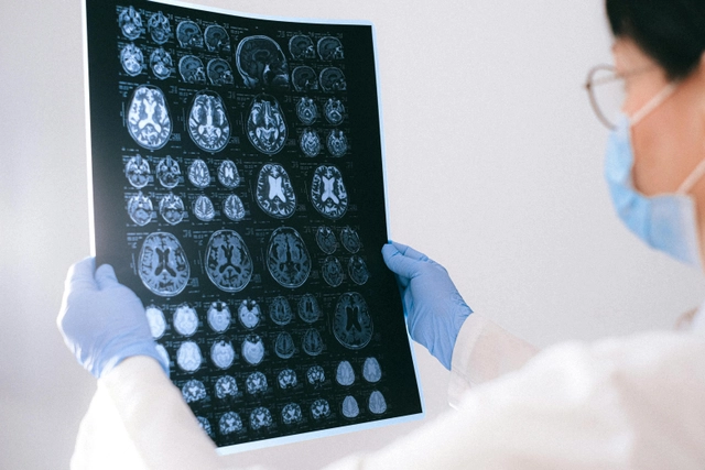 Understanding Dementia: Exploring neurodegenerative disease through real world case studies